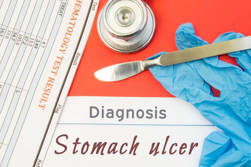 10 Popular Treatments for Stomach Ulcers