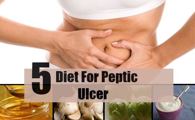 5 Best And Effective Diet Treatment For Peptic Ulcer