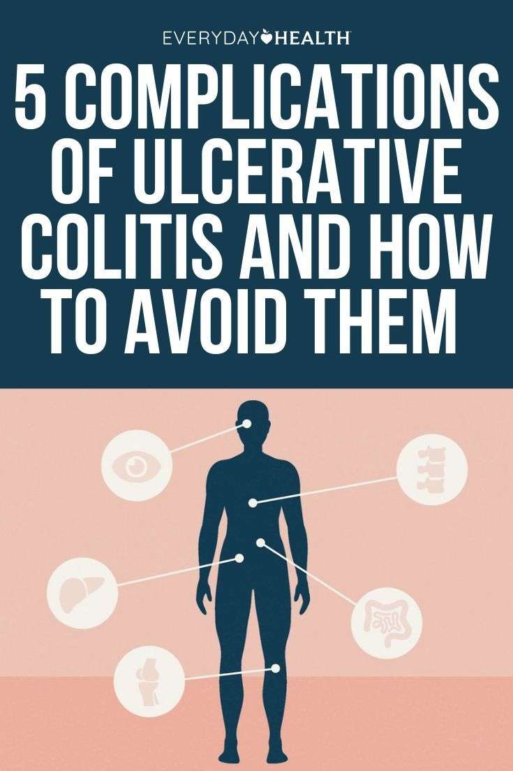5 Complications of Ulcerative Colitis and How to Avoid ...