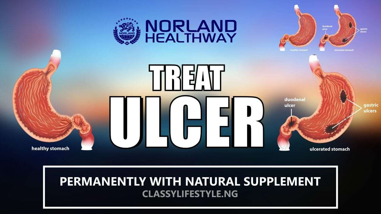 60 Days Natural Solution For Ulcers