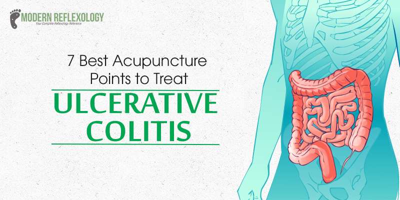 7 Beneficial Acupuncture Points For Ulcerative Colitis Treatment
