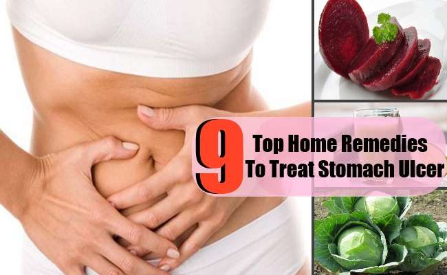 9 Top Home Remedies To Treat Stomach Ulcer