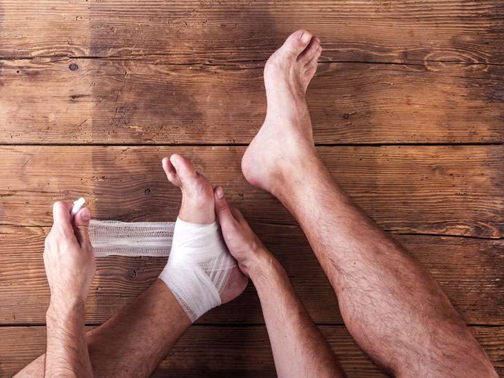 Ankle Ulcers: Causes, Symptoms, Treatments