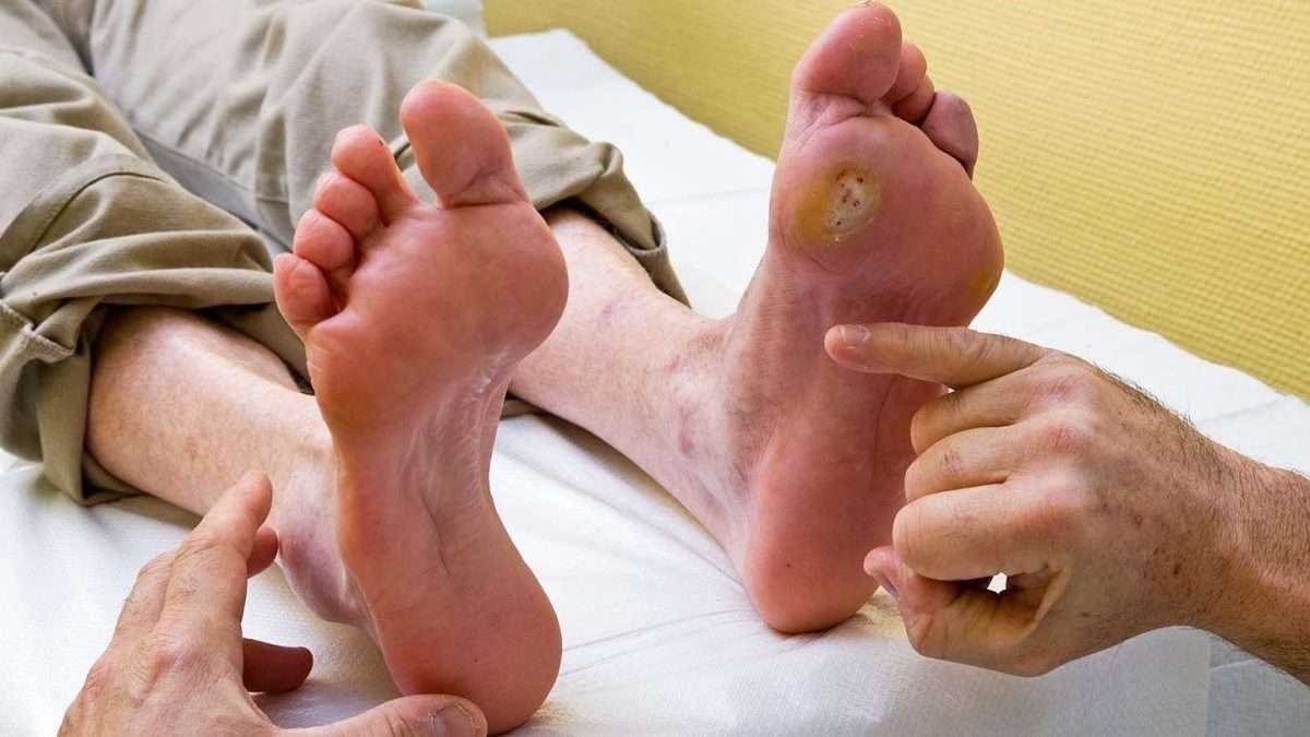 Can Hyperbaric Wound Care Treat Diabetic Foot Ulcers?