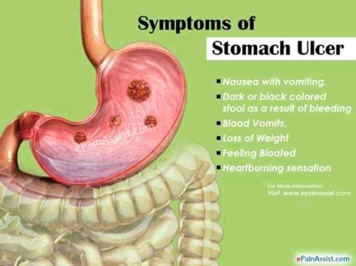 Complications of stomach Ulcer, Foods To Avoid