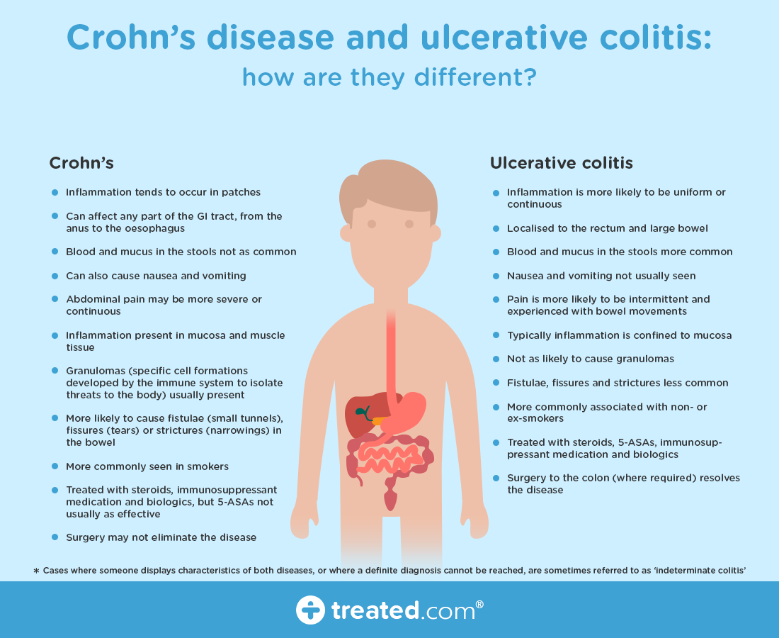 CROHNS DISEASE AND ULCERATIVE COLITIS AND HOW THEY ARE ...