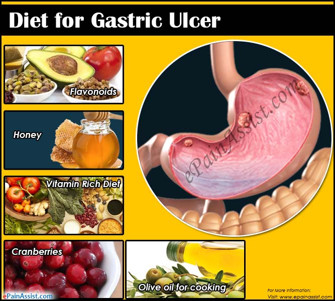 Diet for Gastric Ulcer