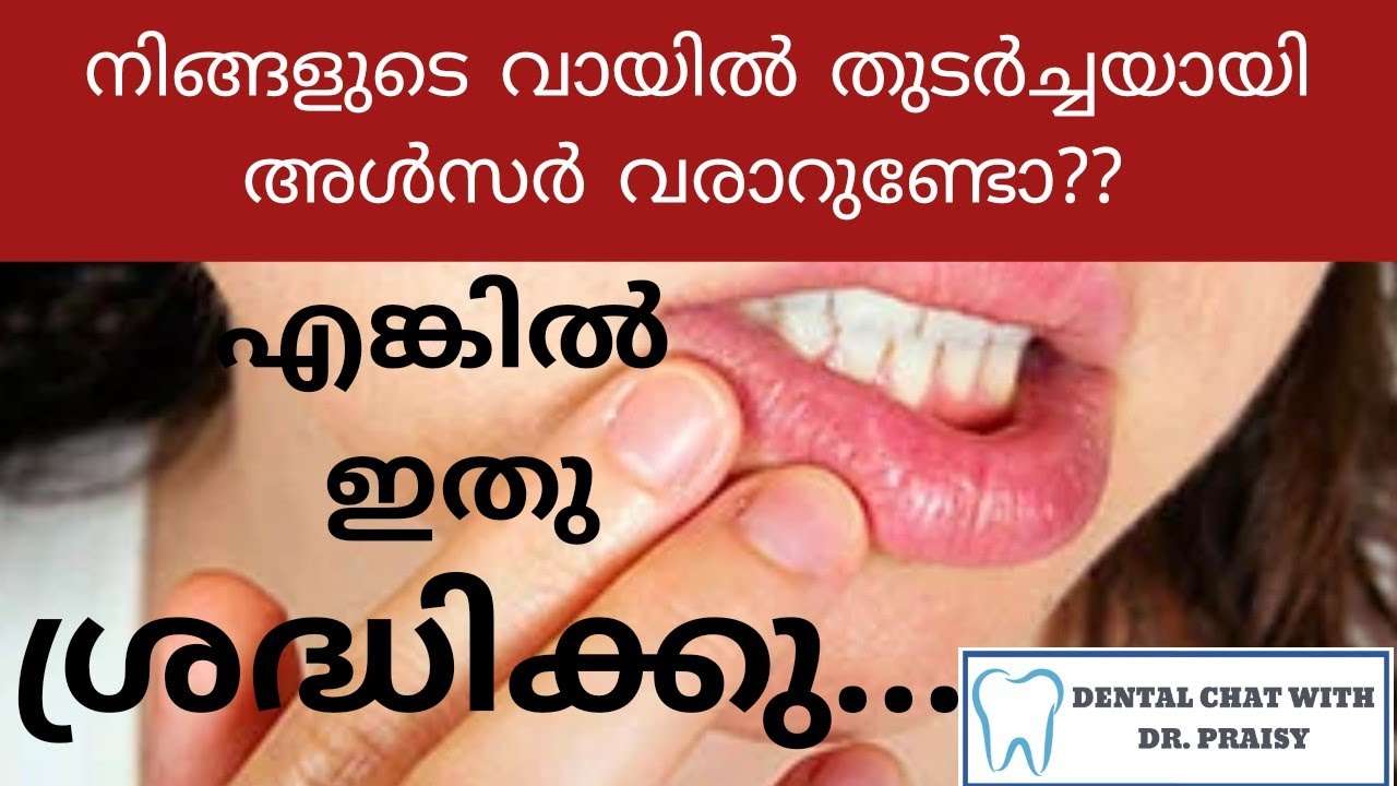 Do you have recurrent mouth ulcers?? How to relieve pain ...