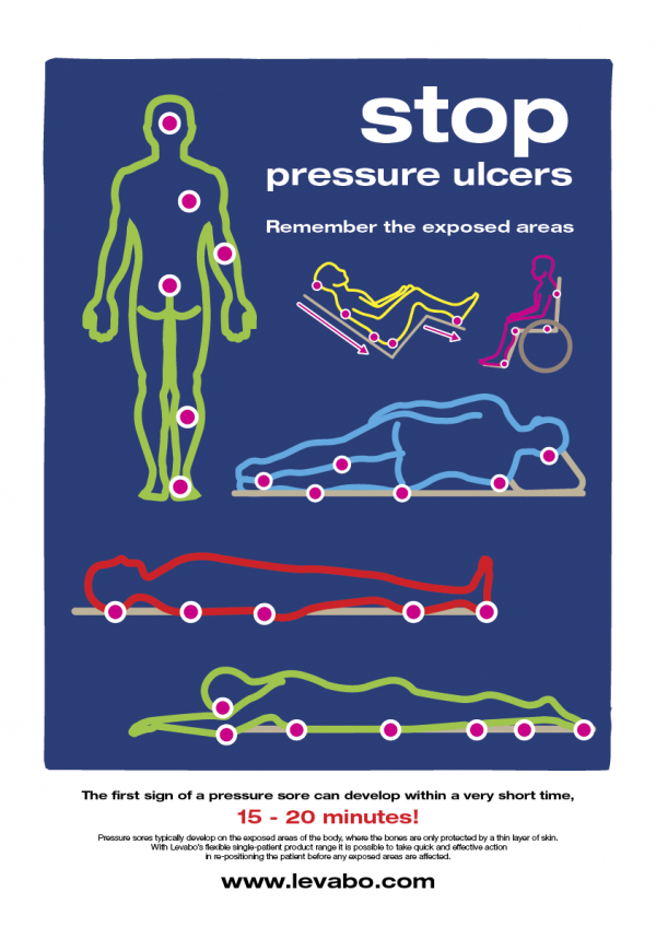 Download Poster " Stop Pressure Ulcers" 