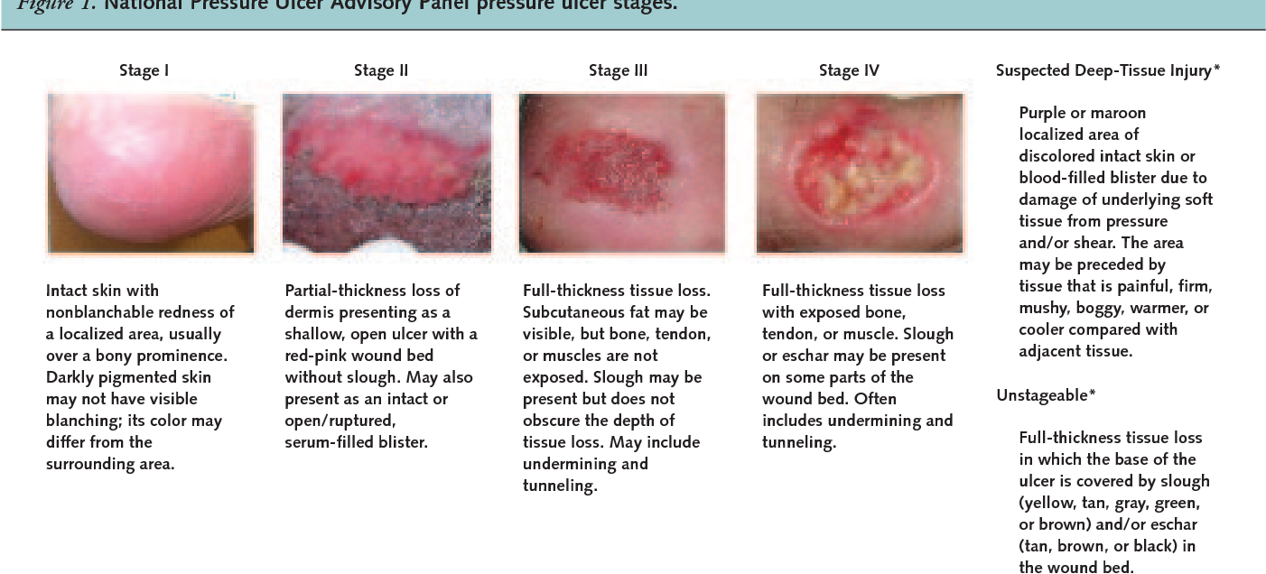 Figure 1 from Pressure ulcer treatment strategies: a ...
