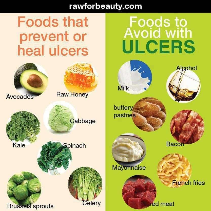 Foods that prevent or heal ulcers