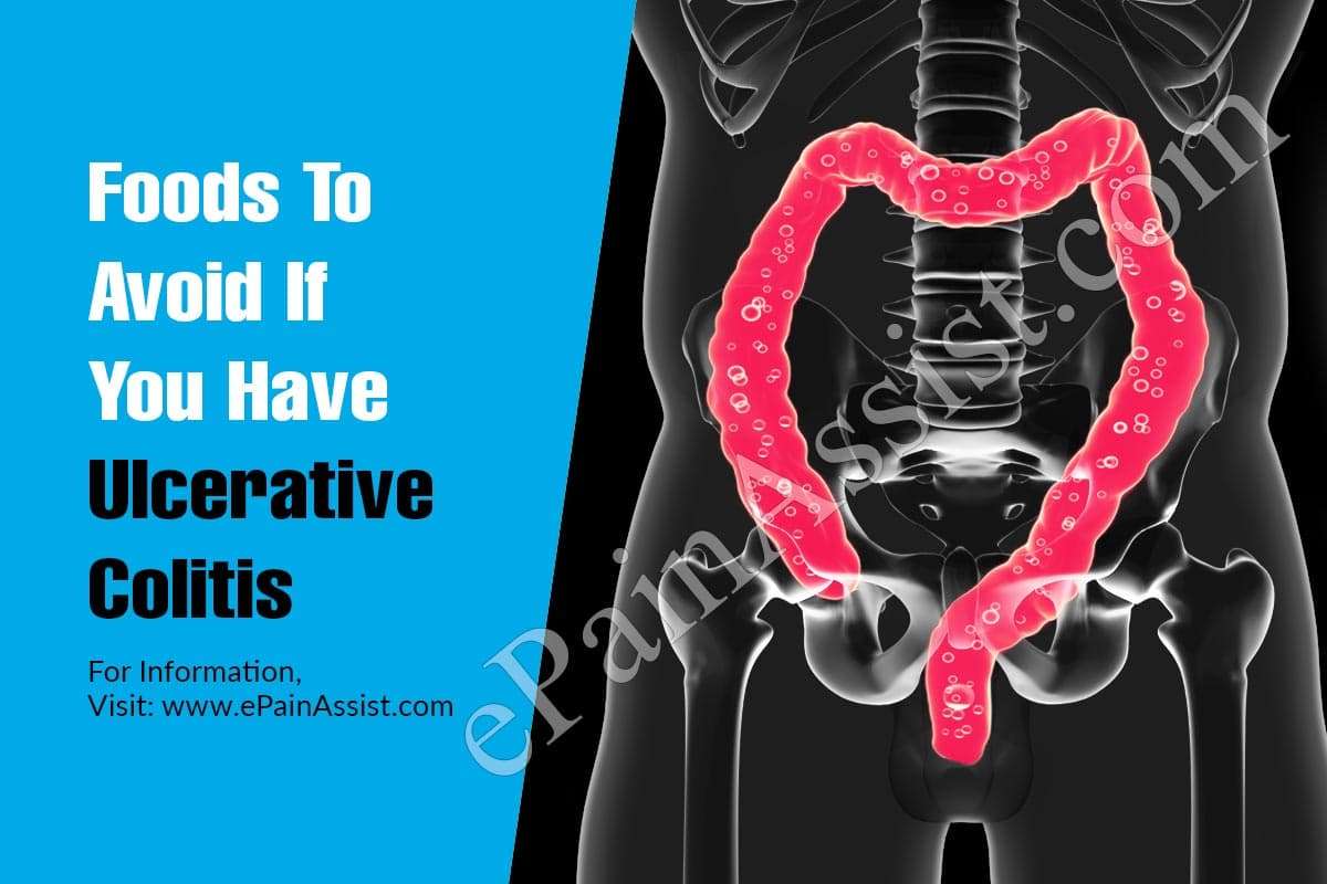 Foods To Avoid If You Have Ulcerative Colitis