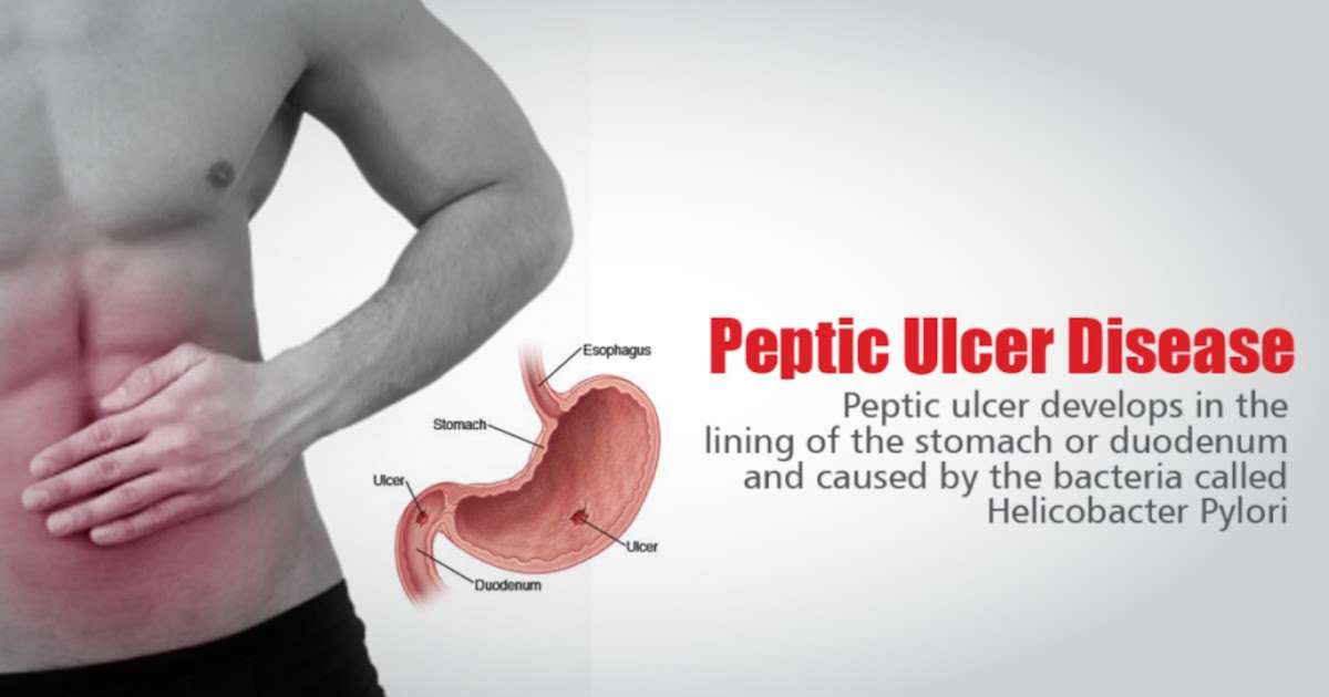 Forever products for Peptic Ulcer (Stomach Ulcer)