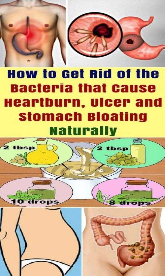Get Rid Of The Bacteria In Your Stomach That Causes Ulcer, Heartburn ...