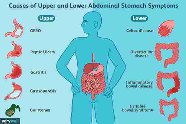 Heartburn And Upper Stomach Pain Infections Gi Hiv ...