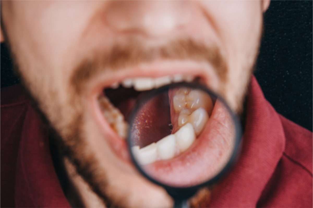 HIV Mouth Symptoms That You should Know