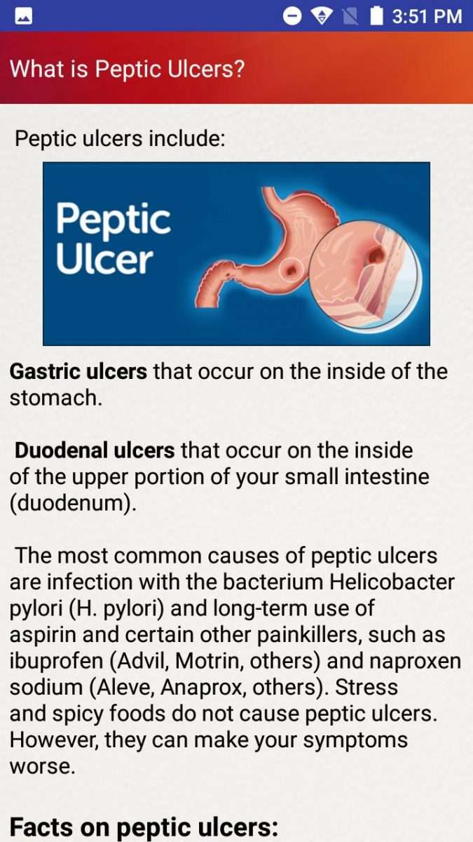 How To Stop Stomach Ulcer Pain Fast ~ loedesigns