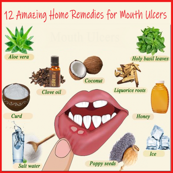How To Treat Mouth Ulcers In Dogs â ho.modulartz.com