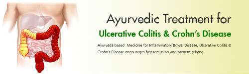 Online Effective Treatment for Ulcerative Colitis
