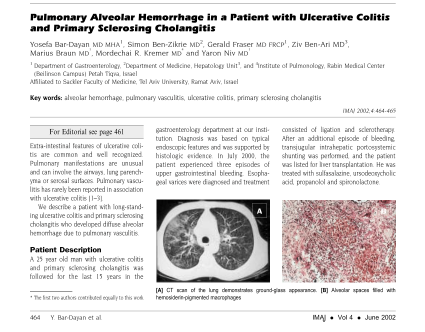 (PDF) Pulmonary alveolar hemorrhage in a patient with ...