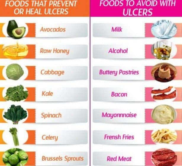 Peptic Ulcer Disease Diet