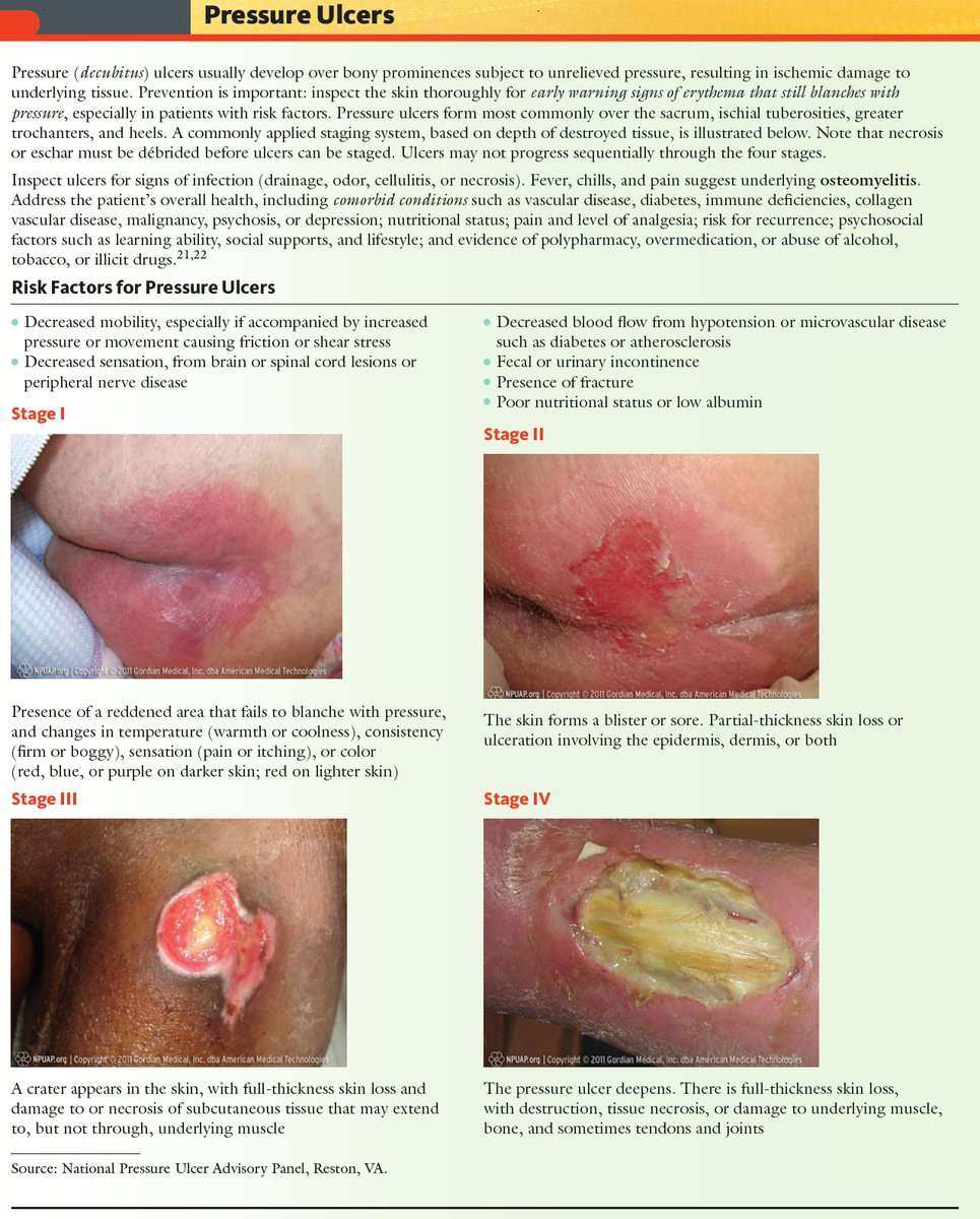 Pressure (Decubitus) Ulcer Staging Stage I Presence ...
