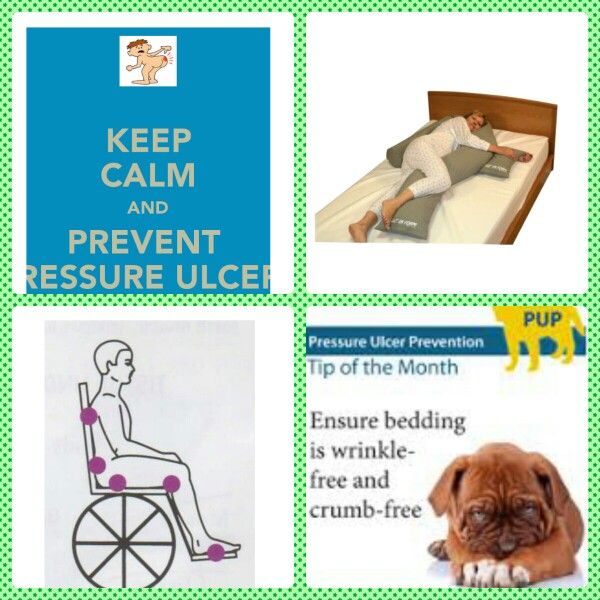 Pressure Ulcer ... it can be prevented!