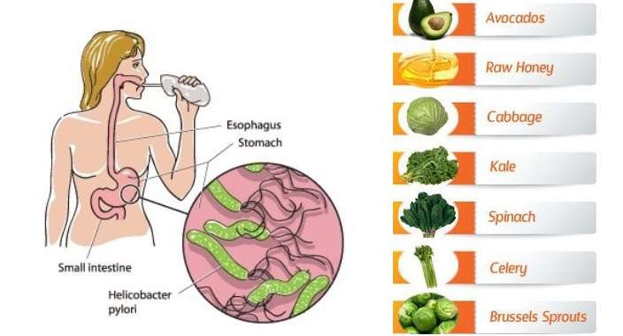 Prevent and Treat Stomach Ulcers With These 7 Foods ...