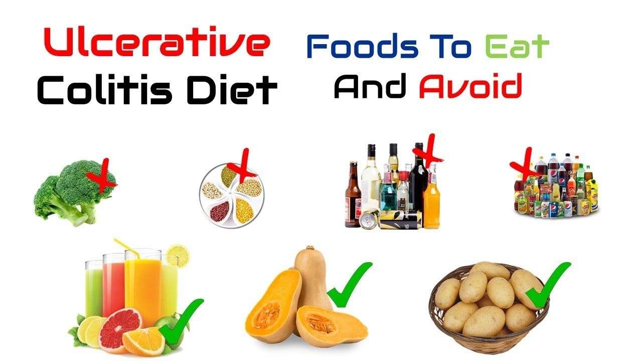#Prevention of #Ulcerative #Colitis with #Natural #Remedies and #Diet