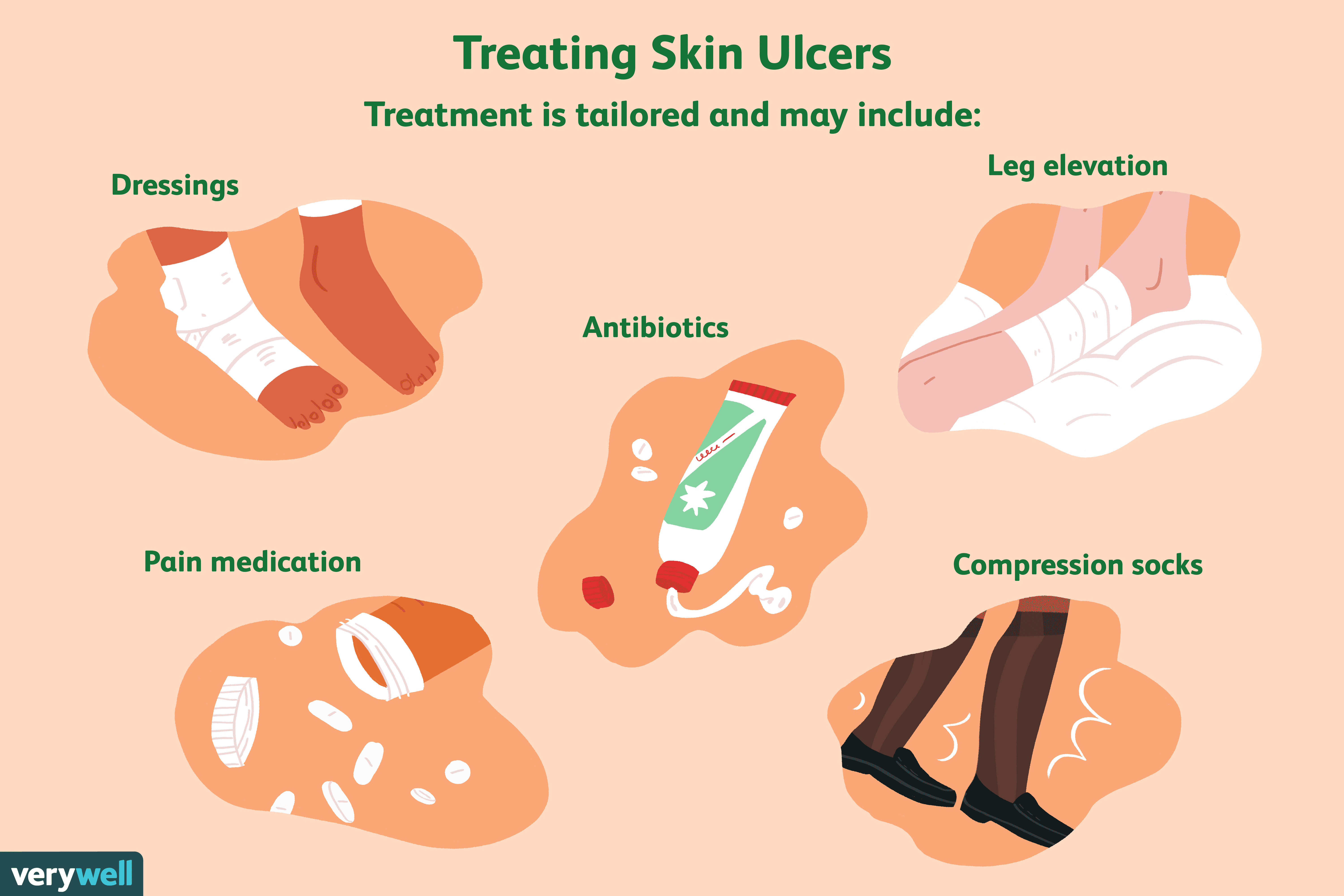Skin Ulcers: Symptoms, Causes, Diagnosis, and Treatment