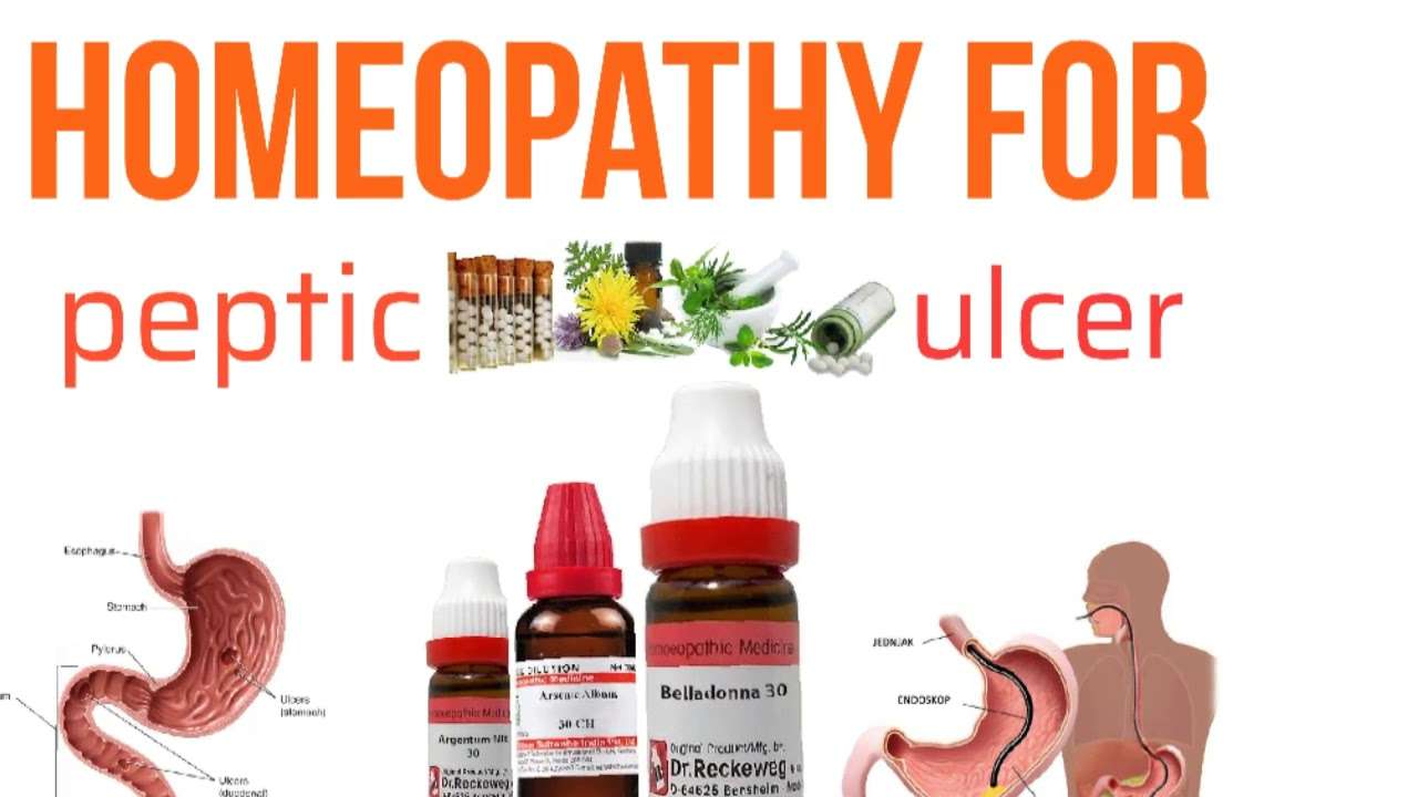 Stomach and Peptic ulcer treatment with homeopathy