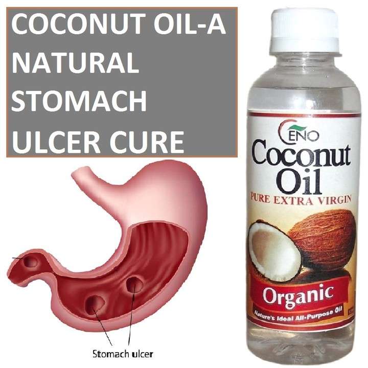 Stomach Ulcer And Virgin Cold Pressed Coconut Oil
