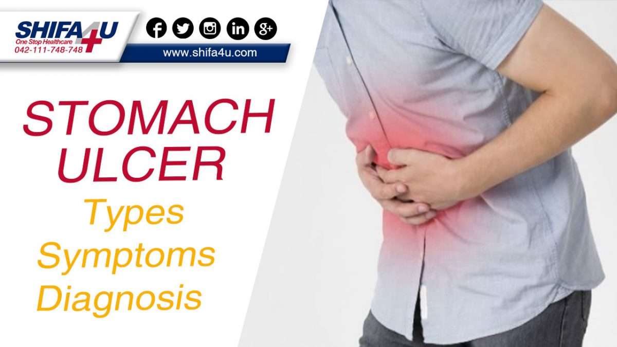 Stomach Ulcer: Types
