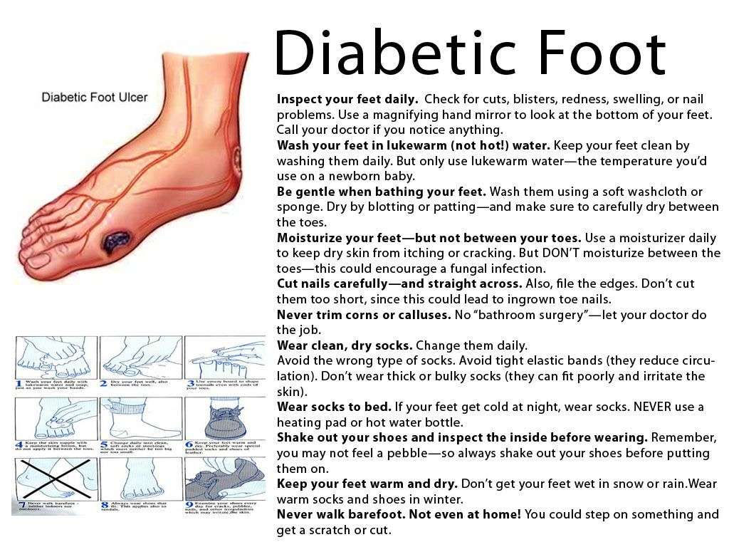 Symptoms of a Diabetic Foot one should know #diabeticfeet