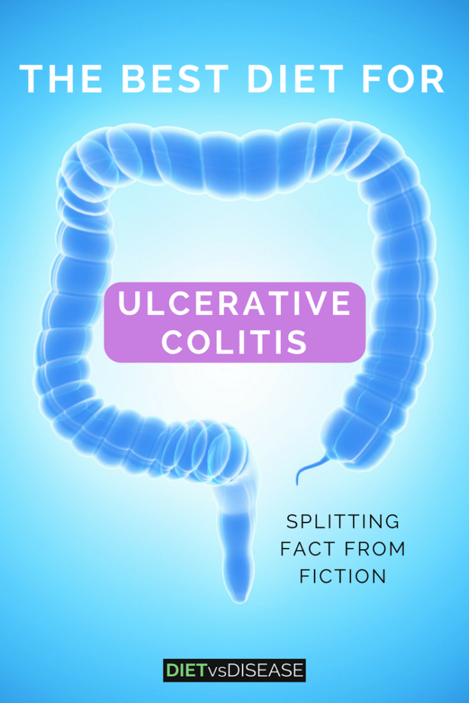The Best Diet For Ulcerative Colitis: Splitting Fact From Fiction