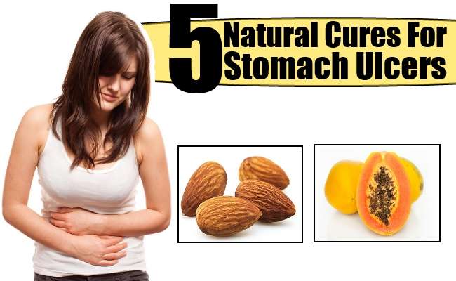 Top 5 Natural Cures For Stomach Ulcers â Natural Home Remedies ...