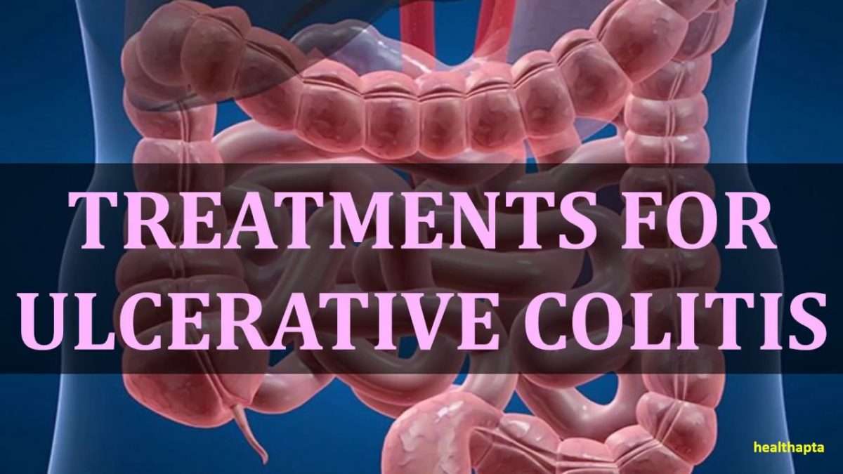 TREATMENTS FOR ULCERATIVE COLITIS