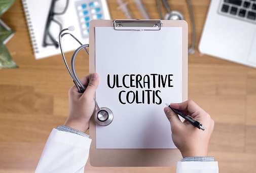 Ulcerative Colitis Healthcare Modern Medical Doctor ...