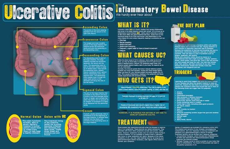 Ulcerative Colitis &  Stem cells Therapy