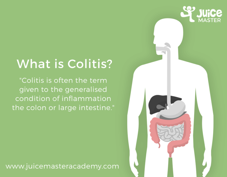 What is the best juice for Colitis?